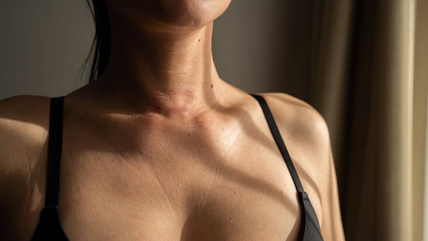 Jod-in-der-Perimenopause